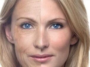 Pigmentazione della pelle