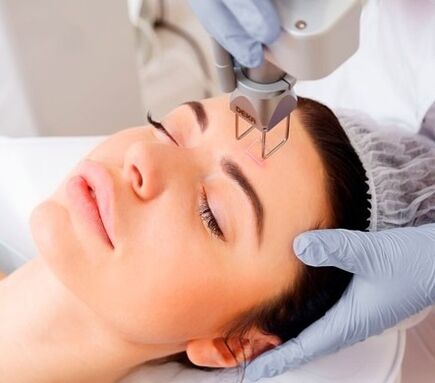 l'essenza della procedura di ringiovanimento della pelle del viso con laser frazionato