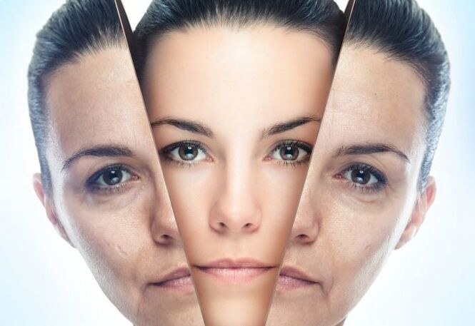 Il processo di eliminazione dei cambiamenti legati all'età nella pelle del viso